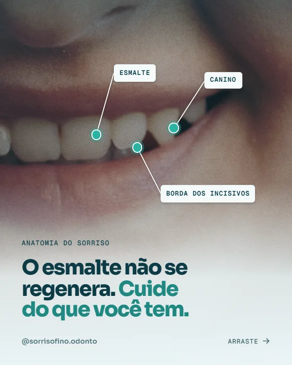 Post de Odontologia, estilo Foto anotada